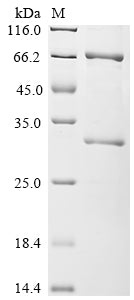 Recombinant Pseudomonas aeruginosa Exotoxin A regulatory protein (toxR)