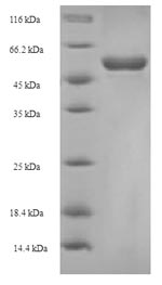 Recombinant Escherichia coli 3-oxoacyl-[acyl-carrier-protein] synthase 2 (fabF)
