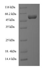Recombinant Escherichia coli Lipopolysaccharide assembly protein B (lapB), partial