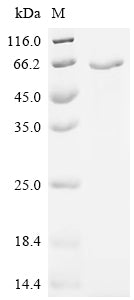 Recombinant Sendai virus Hemagglutinin-neuraminidase (HN), partial
