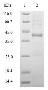 Recombinant Human HLA class II histocompatibility antigen, DRB1 beta chain (HLA-DRB1), partial