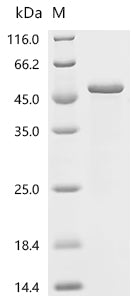 Recombinant Measles virus Nucleoprotein (N), partial