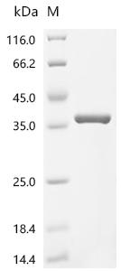Recombinant Escherichia coli Formamidopyrimidine-DNA glycosylase (mutM)