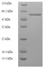 Recombinant Human parvovirus B19 Minor capsid protein VP1, partial