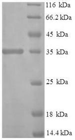 Recombinant Human Interferon alpha-1/13 (IFNA1)