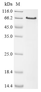 Recombinant Human papillomavirus type 16 Minor capsid protein L2 (L2), partial
