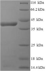Recombinant Human respiratory syncytial virus A Major surface glycoprotein G (G), partial