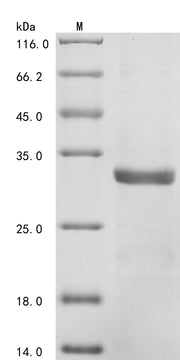 Recombinant Mouse C-C motif chemokine 21c (Ccl21c)