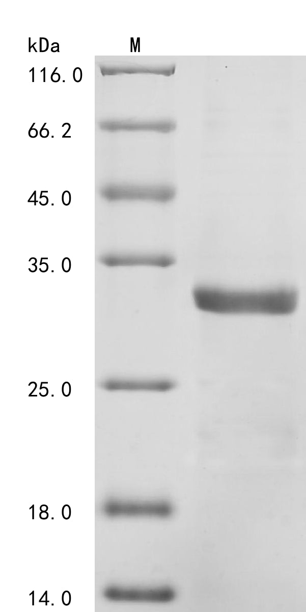 Recombinant Mouse C-C motif chemokine 21c (Ccl21c)
