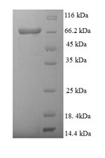 Recombinant Danio rerio D-2-hydroxyglutaRate dehydrogenase, mitochondrial (d2hgdh)