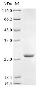 Recombinant Coxiella burnetii Uncharacterized protein (CBU_0425), partial