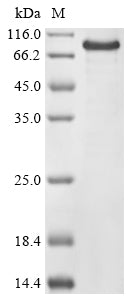Recombinant Bifidobacterium bifidum NCIMB 41171 Beta-galactosidase (bbgII)