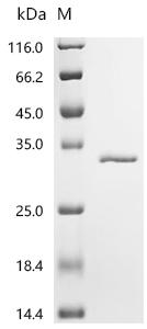 Recombinant Mycobacterium tuberculosis Uracil phosphoribosyltransferase (upp)