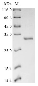 Recombinant White-tufted-ear marmoset Thymic stromal lymphopoietin (TSLP), partial