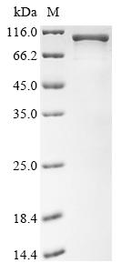 Recombinant Angiostrongylus cantonensis Galectin