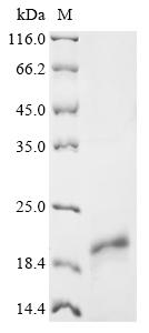Recombinant Human immunodeficiency virus type 1 Protein Tat (tat)