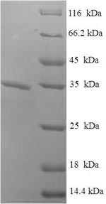 Recombinant Loxosceles amazonica Phospholipase D LamSicTox-alphaIC1