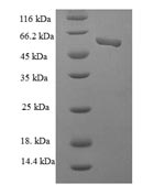 Recombinant Human Casein kinase II subunit alpha' (CSNK2A2), partial