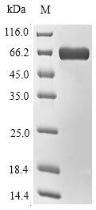 Recombinant Pyrococcus horikoshii L-aspartate oxidase (nadB)