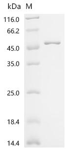 Recombinant Rice tungro bacilliform virus Polyprotein, partial (I669V)