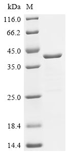 Recombinant Human cDNA FLJ11751 fis, clone HEMBA1005576, moderately similar to Mus musculus plexin 2 (H11Y,S17F)