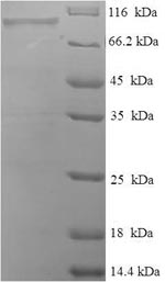 Recombinant Human Peroxisomal bifunctional enzyme (EHHADH)