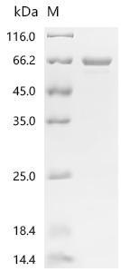 Recombinant Mycobacterium tuberculosis NAD(P)H dehydrogenase (quinone) (lpdA)