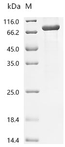 Recombinant Mycobacterium tuberculosis NAD(P)H dehydrogenase (quinone) (lpdA) (Δ284-301)