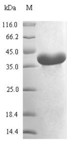 Recombinant Mycoplasma pneumoniae Methionine aminopeptidase (map)