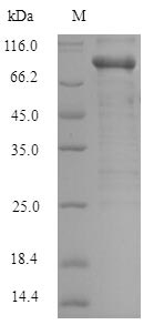 Recombinant Human Serine/threonine-protein kinase PAK 1 (PAK1)