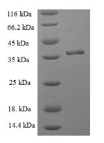 Recombinant Human Peptidyl-tRNA hydrolase ICT1, mitochondrial (ICT1)