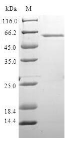 Recombinant Human DNA repair protein XRCC4 (XRCC4)