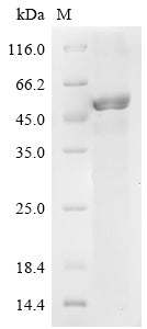 Recombinant Human Ras-related protein Rab-35 (RAB35)