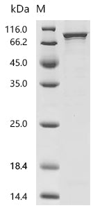 Recombinant Human Phosphoenolpyruvate carboxykinase [GTP], mitochondrial (PCK2)
