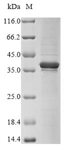 Recombinant Human Four and a half LIM domains protein 1 (FHL1)