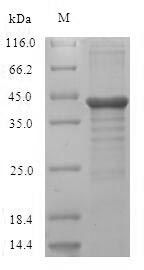 Recombinant Human Protein unc-119 homolog A (UNC119)