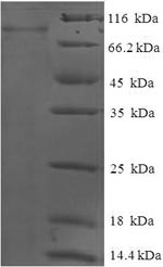 Recombinant Human Glucokinase regulatory protein (GCKR)