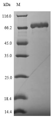 Recombinant Influenza A virus Nucleoprotein (NP)