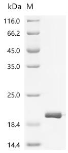 Recombinant Staphylococcus aureus Small ribosomal subunit protein bS16 (rpsP)