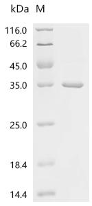 Recombinant Francisella tularensis subsp LPS-assembly protein lptD (lptD), partial