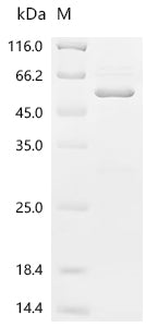 Recombinant Saponaria officinalis Ribosome-inactivating protein saporin-6 (SAP6)&Streptococcus sp. group G Immunoglobulin G-binding protein G (spg)