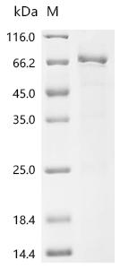 Recombinant Human Autophagy-related protein 2 homolog A (ATG2A), partial