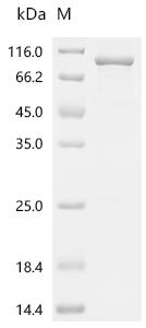 Recombinant Human Prolyl 3-hydroxylase 1 (P3H1)