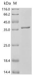 Recombinant Bordetella pertussis BrkA autotransporter (brkA), partial