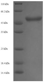Recombinant Staphylococcus aureus Malonyl CoA-acyl carrier protein transacylase (fabD)