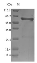 Recombinant Salmonella typhi Outer membrane protein S1 (ompS1)