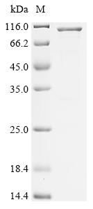 Recombinant Human FYVE, RhoGEF and PH domain-containing protein 3 (FGD3)