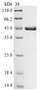 Recombinant Porphyromonas gingivalis Lys-gingipain W83 (kgp), partial