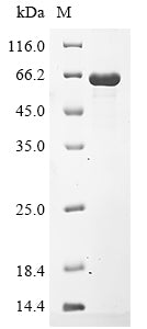 Recombinant Porphyromonas gingivalis Lys-gingipain W83 (kgp), partial