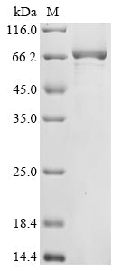 Recombinant Human Ribonuclease ZC3H12A (ZC3H12A)